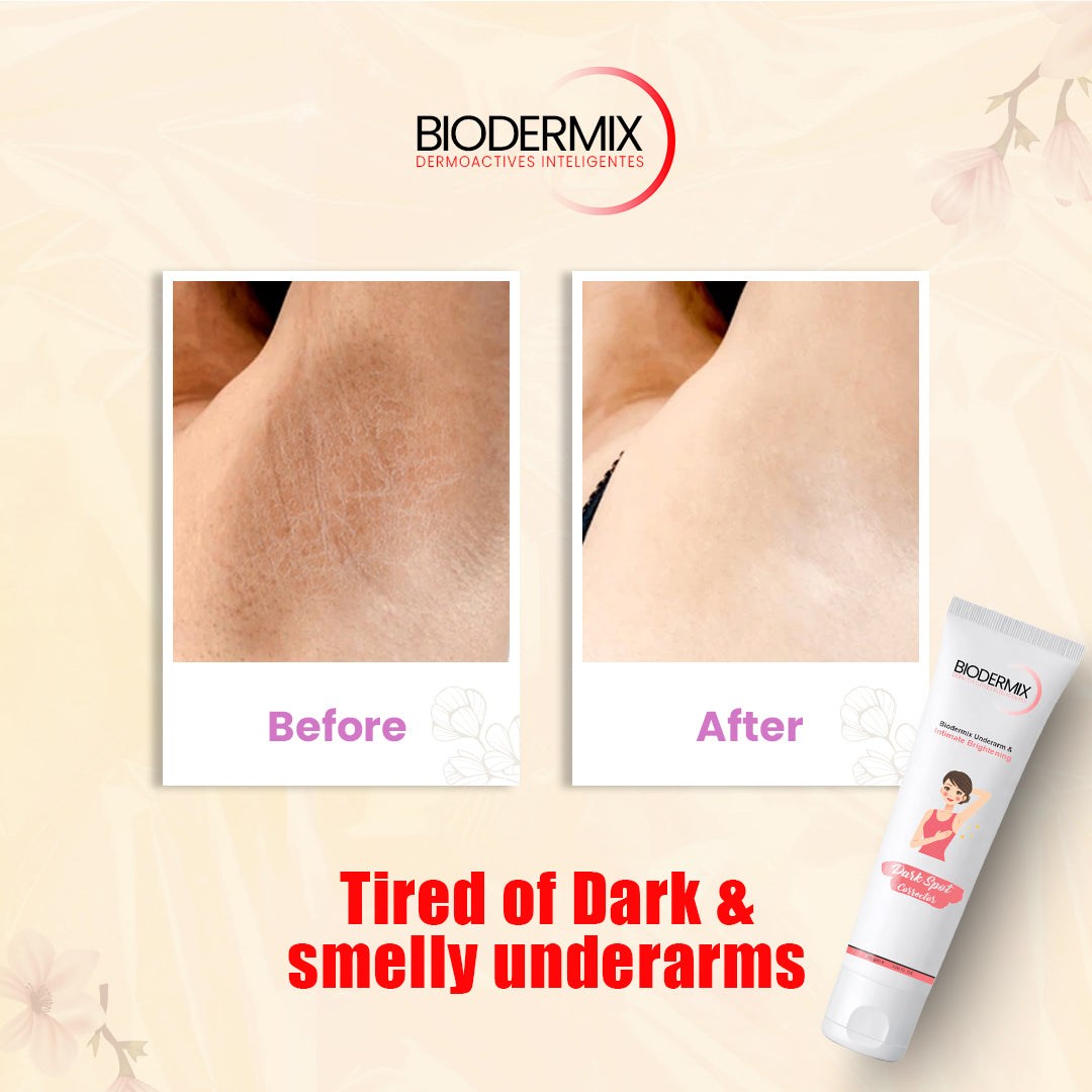 Biodermix Underarm & Intimate Brightening Cream